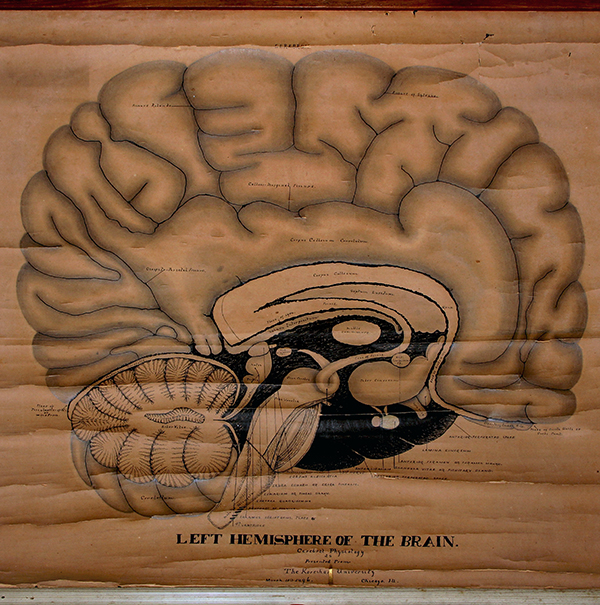 Teed’s chart of the brain, March 11, 1896
